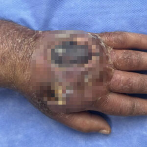 hirsizin isirigi kolundan ediyordu vaka literature girmeye aday deijKdQ2