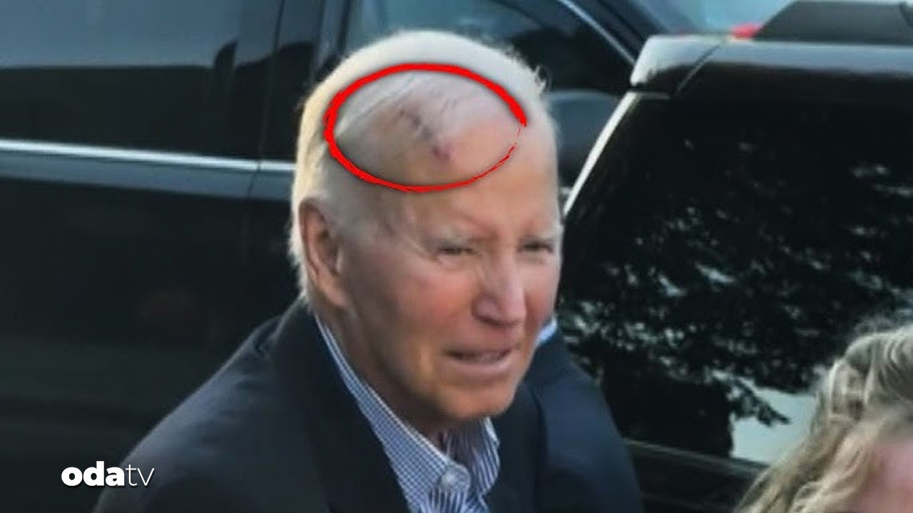 bidena kanser ameliyati V232ylA7