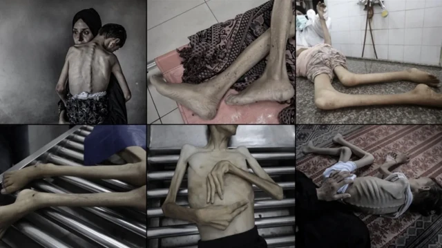 katil israilin kitligi dayattigi gazzede agustos ayinda 185 kisi acliktan yasamini yitirdi RPtsz6A3