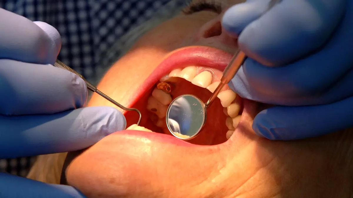 nottingham universitesinden dis minesini onaran yeni jel maB6FxMZ.jpg